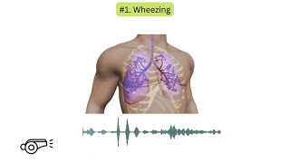 Abnormal lung sounds in COPD [upl. by Maisel63]