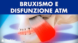 Bruxismo e disfunzione articolazione temporomandibolare © [upl. by Monto]