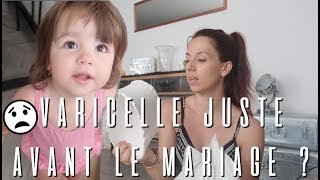 LA VARICELLE JUSTE AVANT LE MARIAGE  😒 VLOG FAMILLE [upl. by Nahsed500]