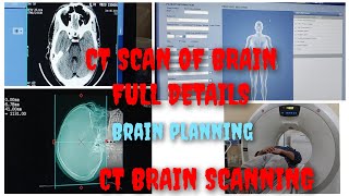 How to do CT scan of brain in GE machine  CT Brain Planning CT scan Brain in details Prasad Layek [upl. by Ransom]