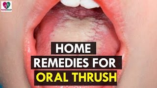 Home Remedies for Oral Thrush  health Sutra [upl. by Ahsenod291]