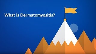 What is Dermatomyositis Inflammatory Disease [upl. by Pilif]