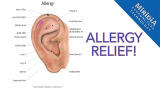 Auriculotherapy for Allergy Relief DIY Allergy Protocol [upl. by Amian]