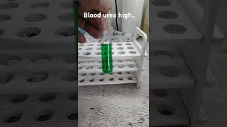 Blood urea test shorts youtube [upl. by Aikan472]