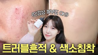 cc 홈케어끝판왕 트러블흔적amp색소침착 쉽게 없애는 진짜 방법🧡ㅣ아랑 [upl. by Marlon]