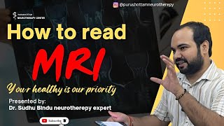 How to read MRI of Spine Lower Back MRI Lumbar Spine MRI Back Pain amp Sciatica MRI [upl. by Sllew232]