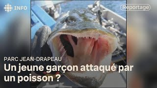 Un jeune garçon transporté à l’hôpital après une morsure de poisson à la plage JeanDoré [upl. by Alurta683]