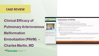 Clinical Efficacy of Pulmonary Arteriovenous Malformation Embolization Terumo Interventional System [upl. by Welby981]