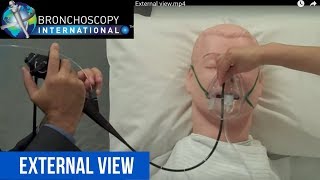 Flexible Bronchoscopy Basic Techniques 2  TBNA External View [upl. by Foster]