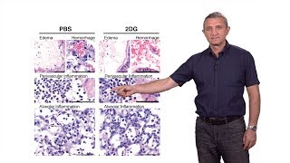 Ruslan Medzhitov Yale  HHMI 2 Inflammation and Disease Tolerance Surviving Acute Illness [upl. by Longan]