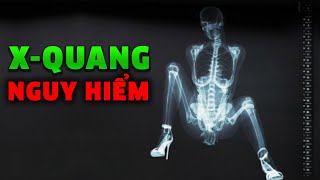 Chuyện NGUY HIỂM gì xảy ra khi bạn chụp XQuang [upl. by Nuahc417]