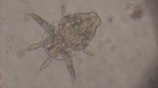 Nauplius Larva of Cyclops crustacean [upl. by Adekram]