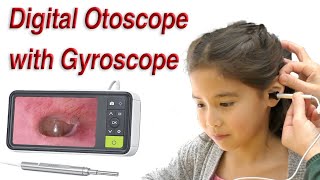 Digital Otoscope with Gyroscope Image Stabilization [upl. by Atilem292]