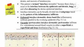 1 Lichenoid Review ✅ Lichen planus 🔸 Lichenoid drug eruption by Dr Ahmed Kamel [upl. by Elena]