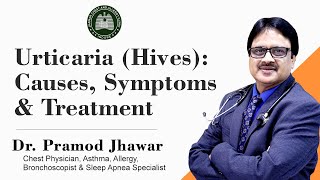 Urticaria Hives  CausesSymptoms amp Treatment [upl. by Nylyahs]