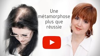 Métamorphose  Perte partielle des cheveux [upl. by Mavilia]