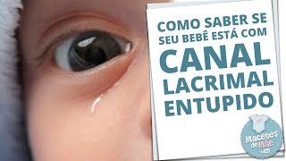 CANAL LACRIMAL ENTUPIDO E COMO TRATAR A OBSTRUÇÃO  MACETES DE MÃE [upl. by Ariad706]