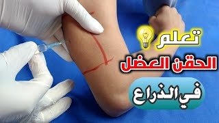 تعلم اعطاء الحقن العضل في الذراع بدلا من المؤخرهLearn to give the im injection in the arm [upl. by Alrad151]