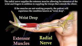 Radial Nerve Palsy injury  WRIST DROP  Everything You Need To Know  Dr Nabil Ebraheim [upl. by Ahkihs]