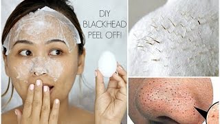 DIY Blackhead Peel Off Mask with an Egg  It Actually WORKS [upl. by Ramunni]