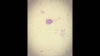 Giardia lamblia por microscopia [upl. by Annasiul594]