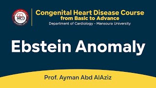 Ebstein Anomaly  Prof Ayman Abd AlAziz [upl. by Aihtnamas622]