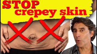 CREPEY SKIN SOLUTIONS  Tighten Loose Skin With These 6 Methods [upl. by Lundt]