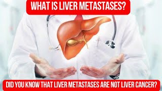 Deciphering LIVER METASTASES Exploring Secondary Liver Cancer [upl. by Tor]