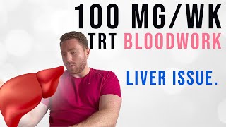 My Blood Work on 100mg Testosterone per Week [upl. by Kcirddet]