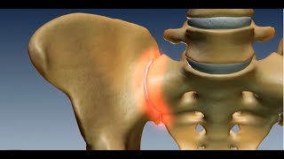 Where is the Sacroiliac Joint Anatomy of the Sacroiliac Joint [upl. by Eisdnyl]