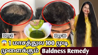 முடி கொட்டி போய் கலக்கமா தெரியுதா Just 30 days போதும்  Best Badness Hair Regrowth Solution at Home [upl. by Abagail439]