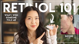 RETINOL 101  beginners guide amp everything I wish I was told [upl. by Ulick]