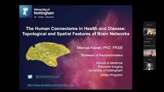 The Human Connectome in Health and Disease Influence of Brain Networks on Cognition [upl. by Silvano]