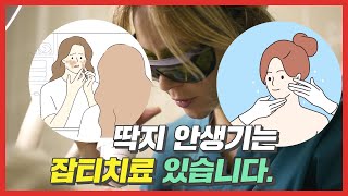 잡티제거 레이저치료 딱지 안생기고 표시나지 않게 치료 할 수 있습니다 [upl. by Jemine298]