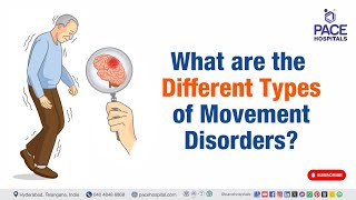 Type of Movement Disorder  What are the Different Types of Movement Disorders  movementdisorder [upl. by Hnao]