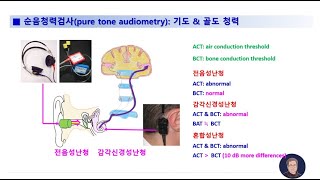 015 골도청력을 측정해야 하는 이유 전음성과 감각신경성 난청의 보청기 조절 전문가난청인 AUampHA [upl. by Aneral]