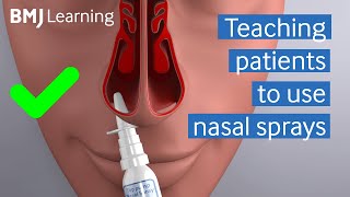 Teaching patients to use nasal sprays  BMJ Learning [upl. by Heater351]