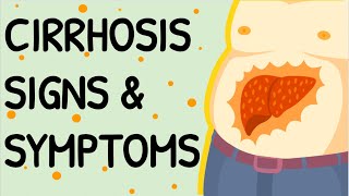 CIRRHOSIS Signs amp Symptoms [upl. by Robaina]