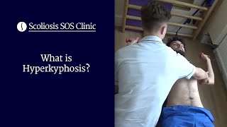 What is Hyperkyphosis  Scheuermanns Disease amp Bad Posture [upl. by Atniuqal]