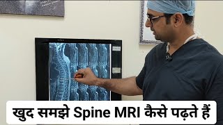 खुद समझे Spine MRI कैसे पढ़ते हैं  ☎️ 919654095717 [upl. by Witty]