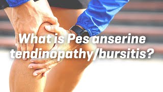 What is Pes anserine tendinopathybursitis [upl. by Naelcm]