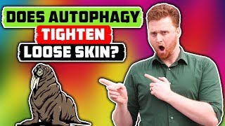 Autophagy Loose Skin How AUTOPHAGY TIGHTENS YOUR SKIN with FASTING [upl. by Dart]