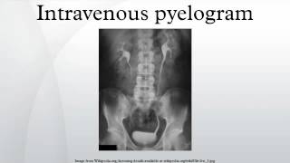 Intravenous pyelogram [upl. by Mchenry790]