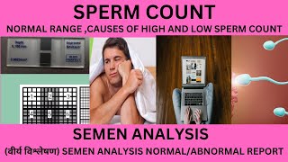 SPERM COUNT IN SEMEN ANALYSIS REPORTHOW MUCH IS THE NORMAL SPERM COUNTLOW SPERM COUNTNO SPERMS [upl. by Atalee]