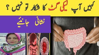 Heal Your Leaky Gut I Leaky Gut Symptoms and How it can be Avoided I Dr Sheheherbano Official [upl. by Gifford]