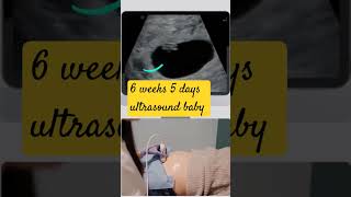 Baby  6 weeks 5 days  ultrasound scan baby pregnancy infant shorts [upl. by Tepper69]