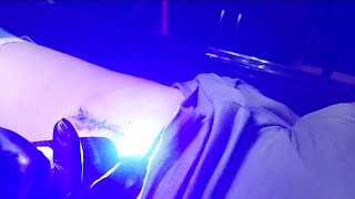 NEATCELL LASER PEN TATTOO REMOVAL Music PixelsMusician Jeff Kaale [upl. by Surbeck]