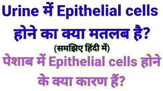 Urine में Epithelial cells होने का क्या मतलब है पेशाब में Epithelilal cells होने के क्या कारण हैं [upl. by Hocker445]