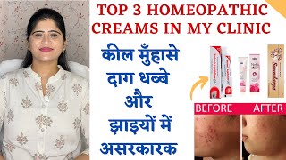 3 Best Homeopathic Creams in my Clinic ॥ कील मुँहासे दाग धब्बे और झाइयों में असरकारक ॥ [upl. by Fairweather]