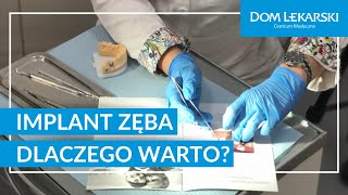 Implanty zębów Dlaczego warto [upl. by Deroo]